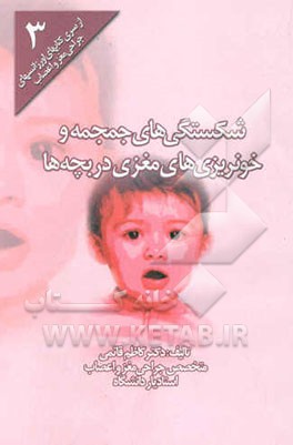 کتاب شکستگی های جمجمه و خونریزی های مغزی در بچه ها اثر کاظم قائمی