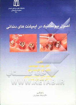 کتاب اصول بیومکانیک در ایمپلنت های دندانی اثر بهزاد هوشمند