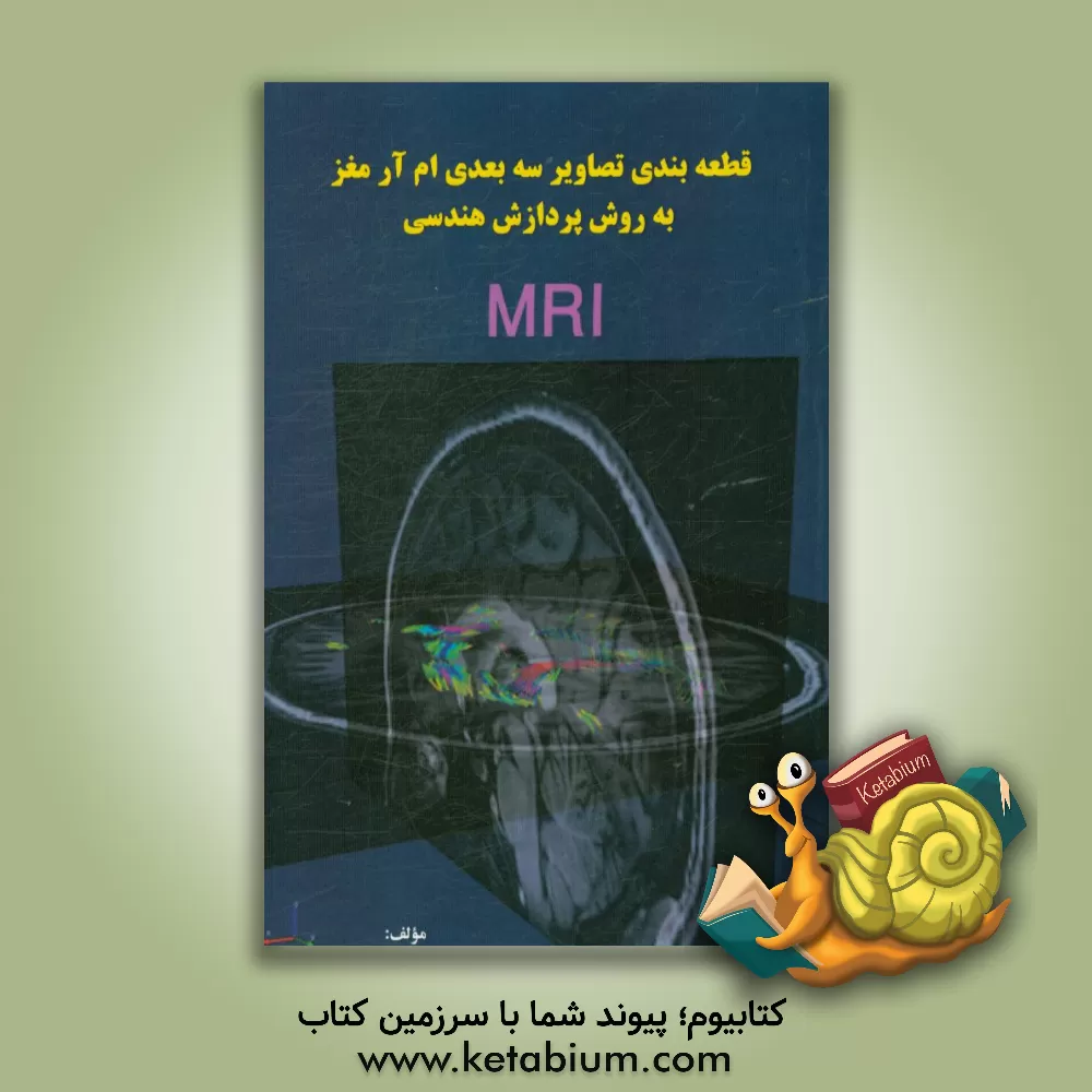 کتاب قطعه بندی تصاویر سه بعدی ام آر آی مغز به روش پردازش هندسی اثر افسون بدیعی