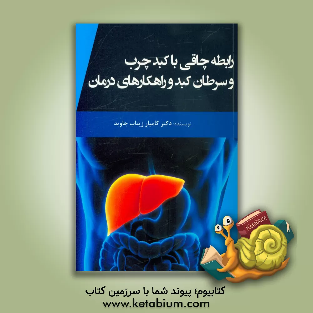 کتاب رابطه چاقی با کبد چرب و سرطان کبد و راهکارهای درمان اثر جون یو