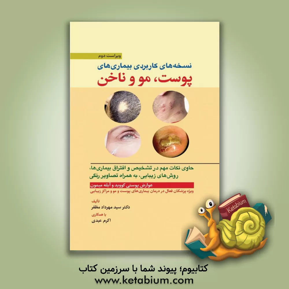 کتاب کامل ترین نسخه های کاربردی بیماری های پوست، مو و ناخن: حاوی نکات مهم در تشخیص و افتراق بیماری ها، تصاویر رنگی و CD آموزشی اثر حسین خلیلی