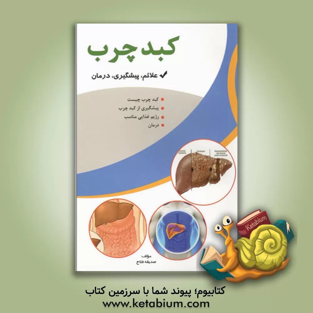 کتاب کبد چرب اثر صدیقه فلاح