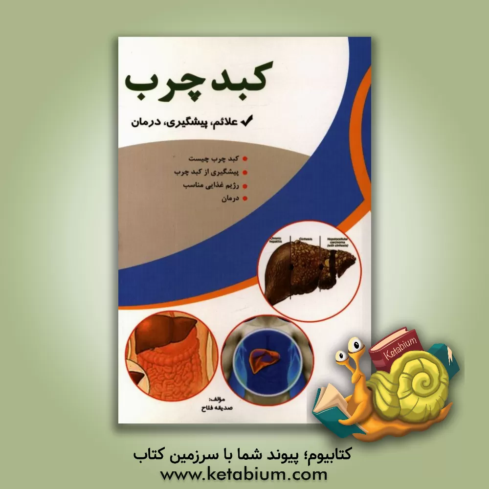 کتاب کبد چرب اثر صدیقه فلاح