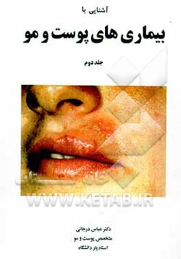 کتاب بیماریهای پوست و مو اثر عباس درجانی