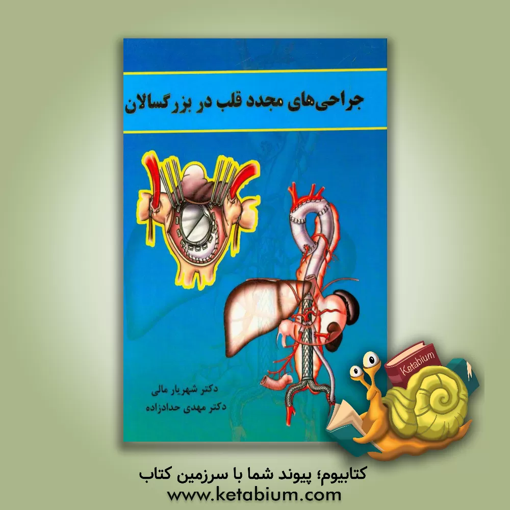 کتاب جراحی های مجدد قلب در بزرگسالان اثر شهریار مالی