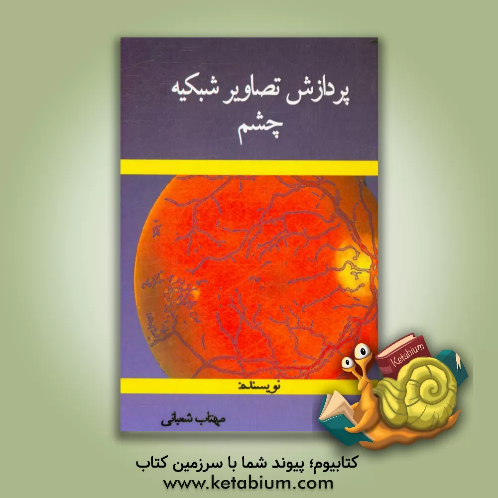 کتاب پردازش تصاویر شبکیه چشم اثر مهتاب شعبانی