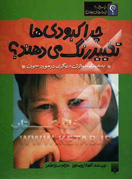 کتاب چرا کبودی ها تغییر رنگ می دهند؟ به همراه سوالات دیگری در مورد خون اثر آنجلا رویستون