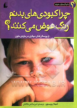 کتاب چرا کبودی های بدنم رنگ عوض می کنند؟ و پرسش های دیگری درباره ی خون اثر آنجلا رویستون