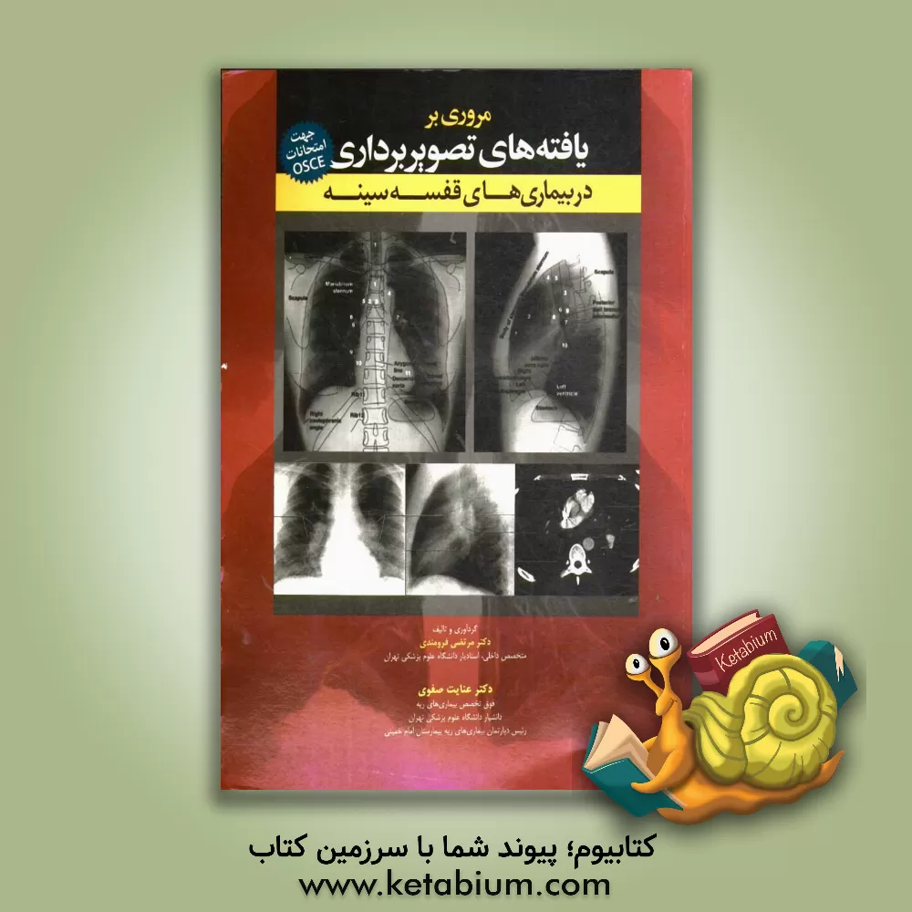 کتاب مروری بر یافته های تصویربرداری در بیناری های قفسه سینه اثر مرتضی فرومندی
