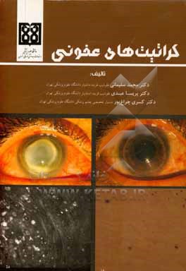 کتاب کراتیت های عفونی اثر محمد سلیمانی