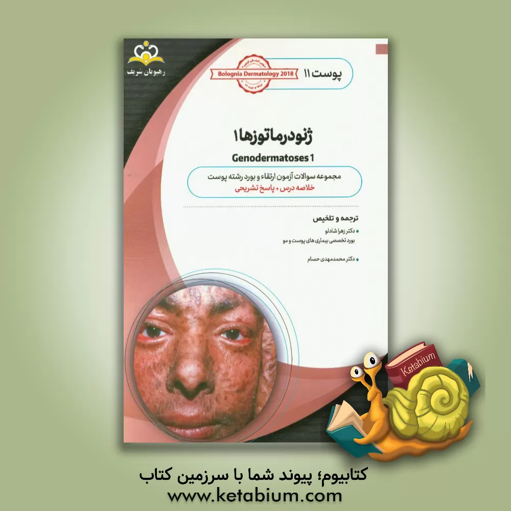 کتاب پوست: ژنودرماتوزها 1: خلاصه درس به همراه مجموعه سوالات آزمون ارتقاء و بورد پوست با پاسخ تشریحی Bolognia Dermatology 2012 کتاب آمادگی آزمون ارتقاء ... اثر زهرا شادلو
