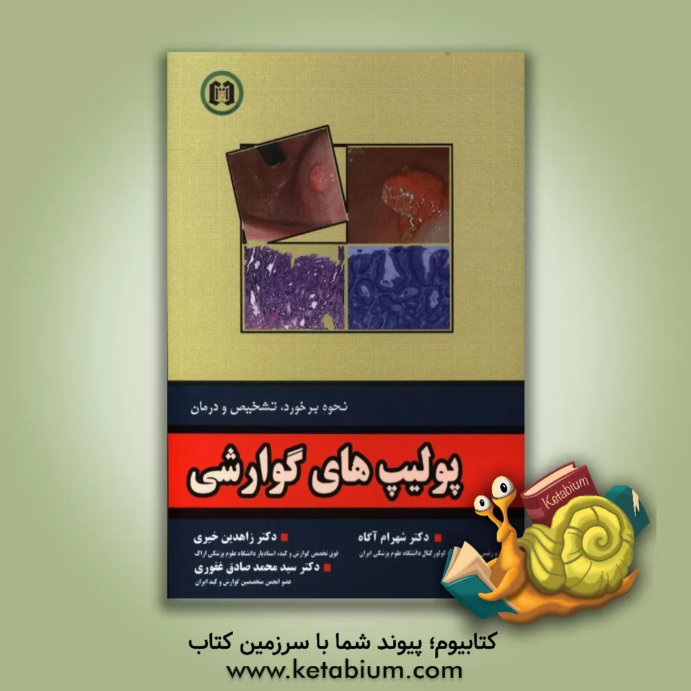 کتاب پولیپ های گوارشی اثر شهرام آگاه