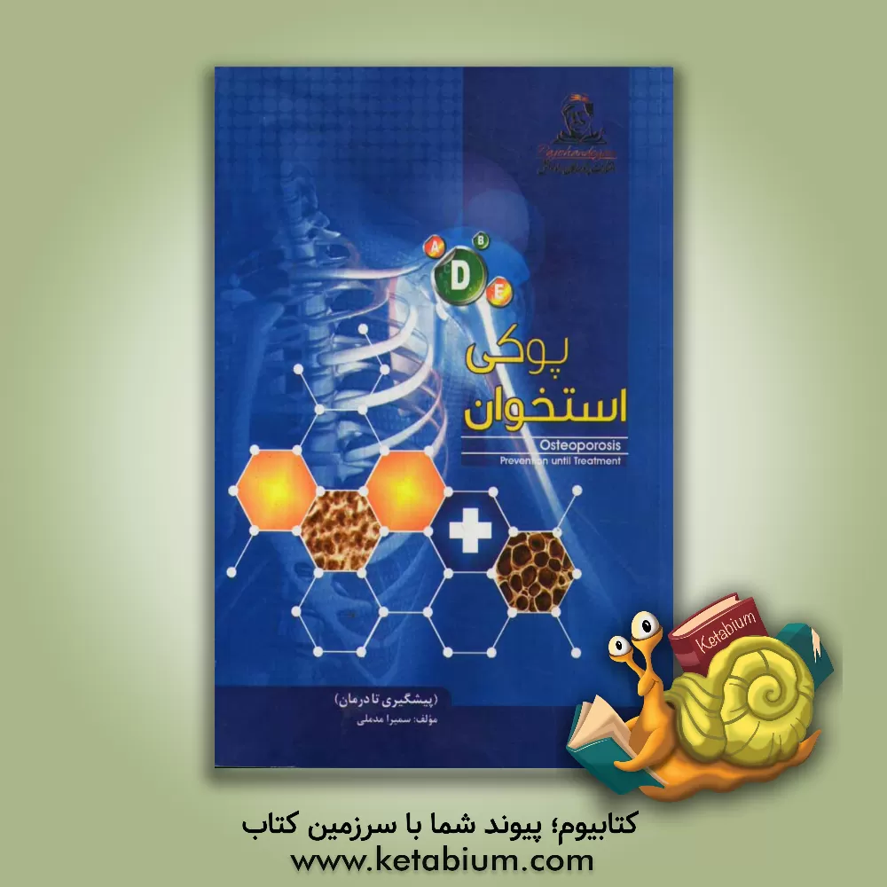 کتاب پوکی استخوان (پیشگیری تا درمان) اثر سمیرا مدملی