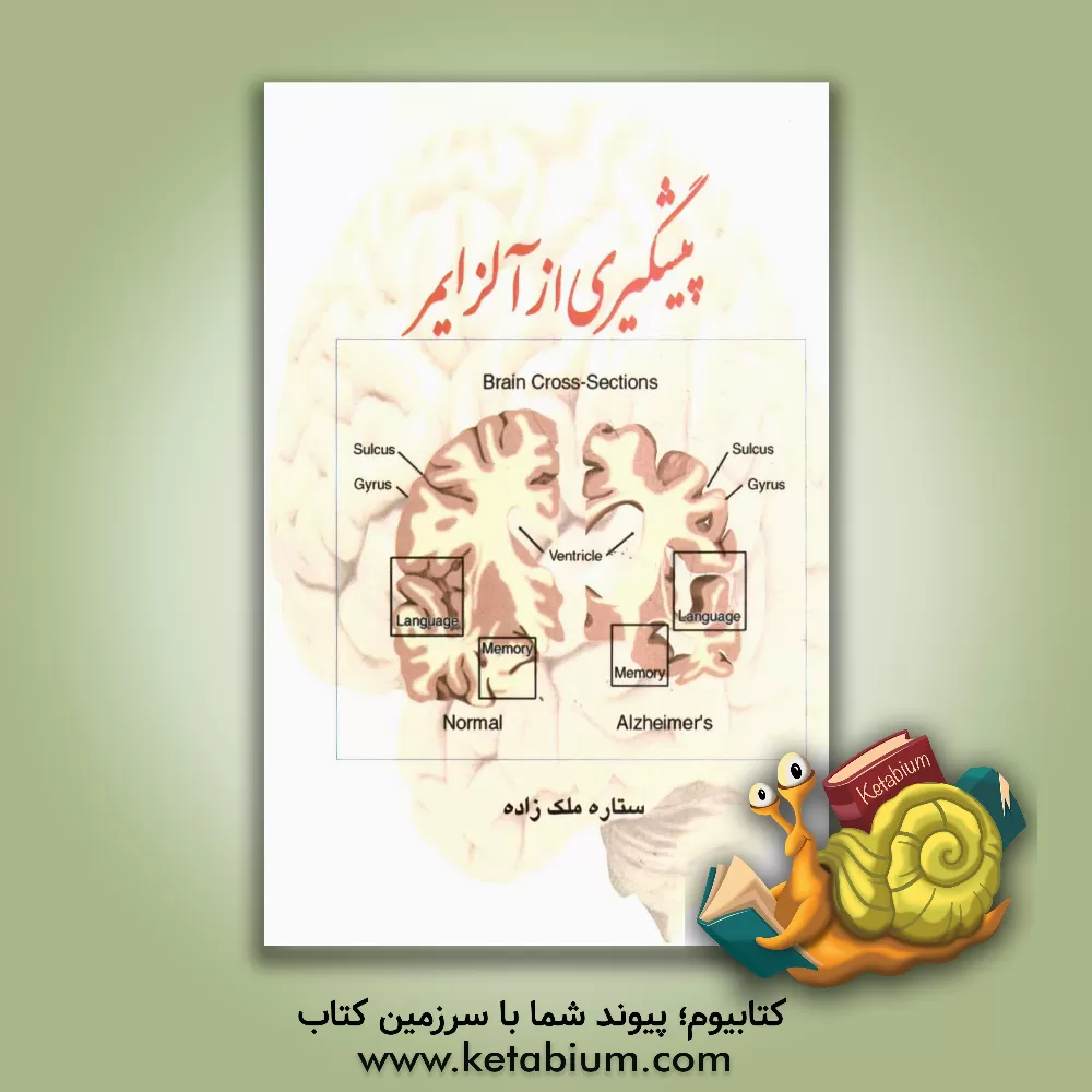 کتاب پیشگیری از آلزایمر اثر ستاره ملک‌زاده