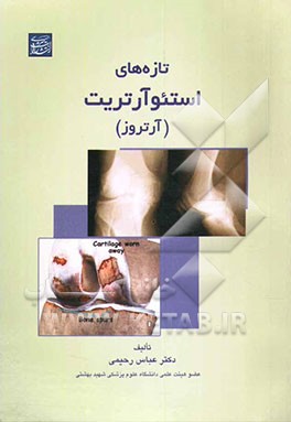 کتاب تازه های استئوآرتریت (آرتروز) اثر عباس رحیمی