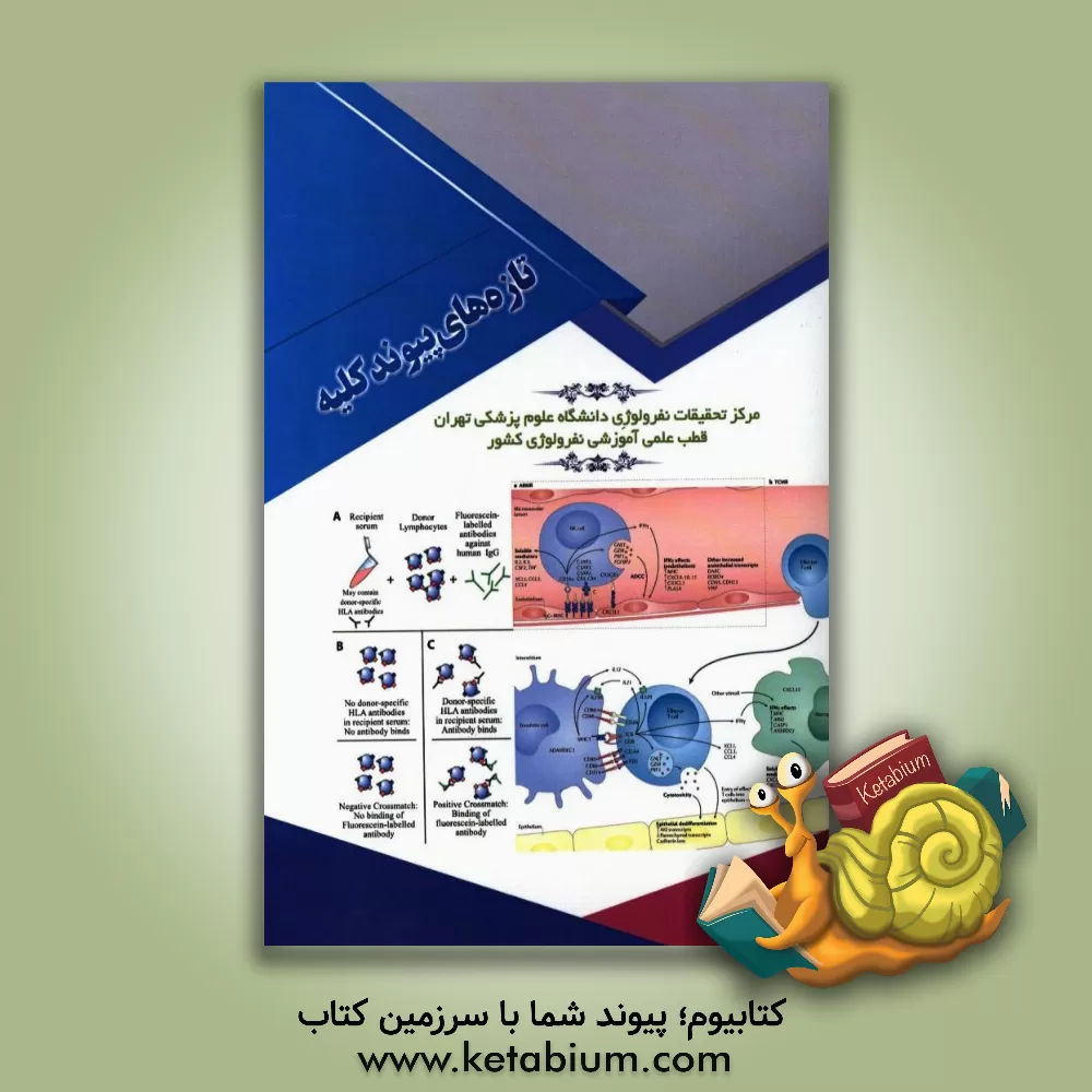 کتاب تازه های پیوند کلیه اثر یدالله شکیبا