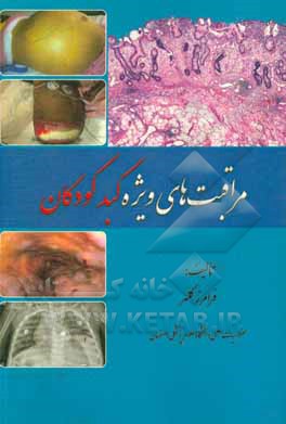 کتاب مراقبت های ویژه کبد کودکان اثر فرامرز کلهر