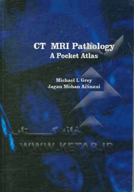 کتاب CT & MRI pathology: a pocket atlas اثر Michael l Grey