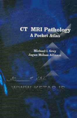 کتاب CT & MRI Pathology: a pocket atlas اثر مایکل‌ال گری