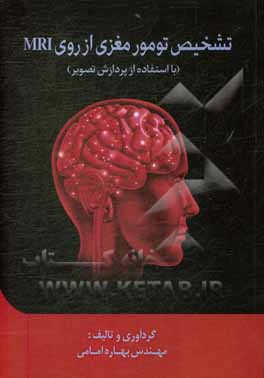 کتاب تشخیص تومور مغزی از روی MRI: با استفاده از پردازش تصویر اثر بهاره امامی