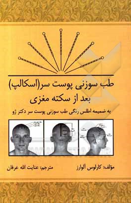 کتاب طب سوزنی پوست سر (اسکالپ) بعد از سکته مغزی اثر کارلوس آلوارز