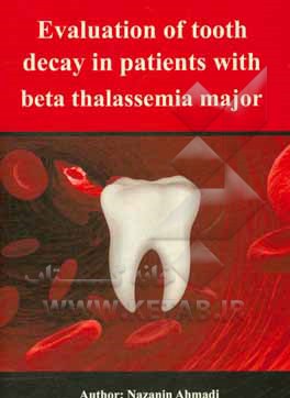 کتاب ‌Evaluation of tooth decay in patients with beta thalassema major اثر نازنین احمدی