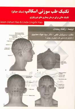 کتاب طب سوزنی اسکالپ، سبک جیائو اثر جیسن جیشون‌هائو