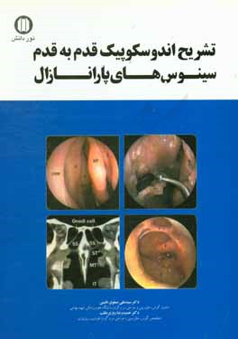 کتاب تشریح اندوسکوپیک: قدم به قدم سینوس های پارانازال اثر سیدعلی صفوی‌نائینی