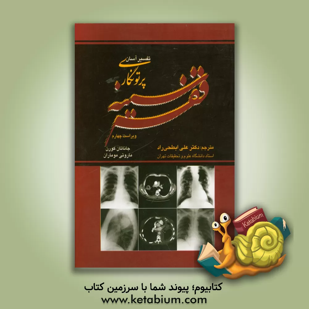 کتاب تفسیر آسان پرتونگاری قفسه سینه اثر جاناتان کارن