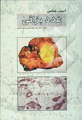 کتاب آسیب شناسی غدد بزاقی اثر سیدضیاء‌الدین مدنی‌کرمانی