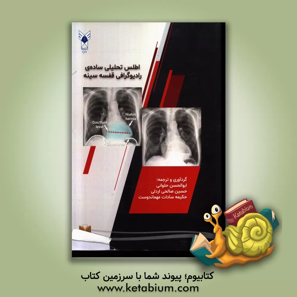 کتاب اطلس تحلیلی ساده ی رادیوگرافی قفسه ی سینه اثر ابوالحسن حلوانی‌