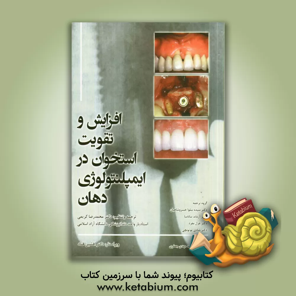 کتاب افزایش و تقویت استخوان در اپمیلنتولوژی دهان اثر محمدرضا کریمی