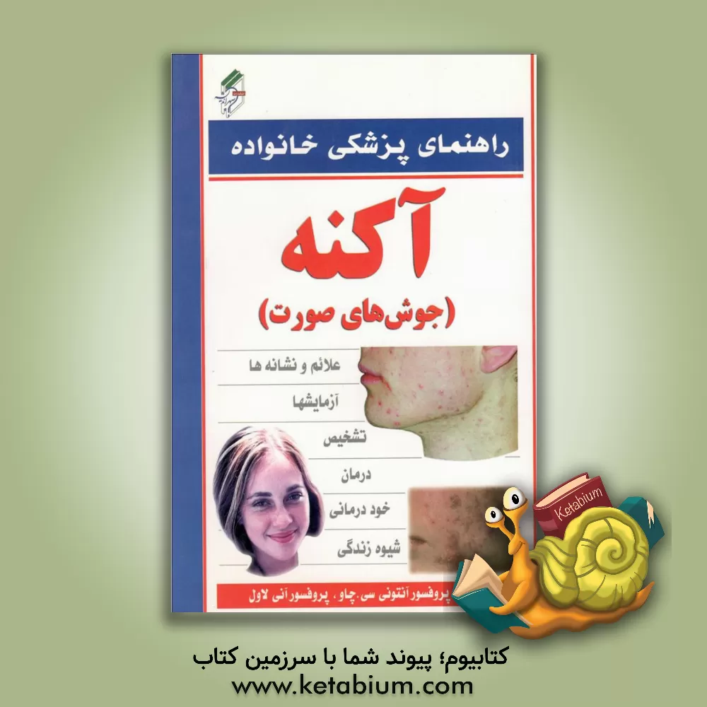 کتاب آکنه اثر آنتونی سی چاو