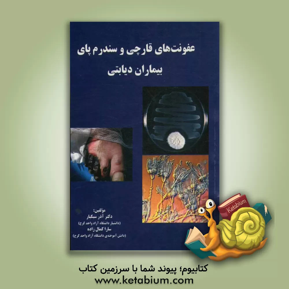 کتاب عفونت های قارچی و سندرم پای بیماران دیابتی اثر سارا کمال‌زاده