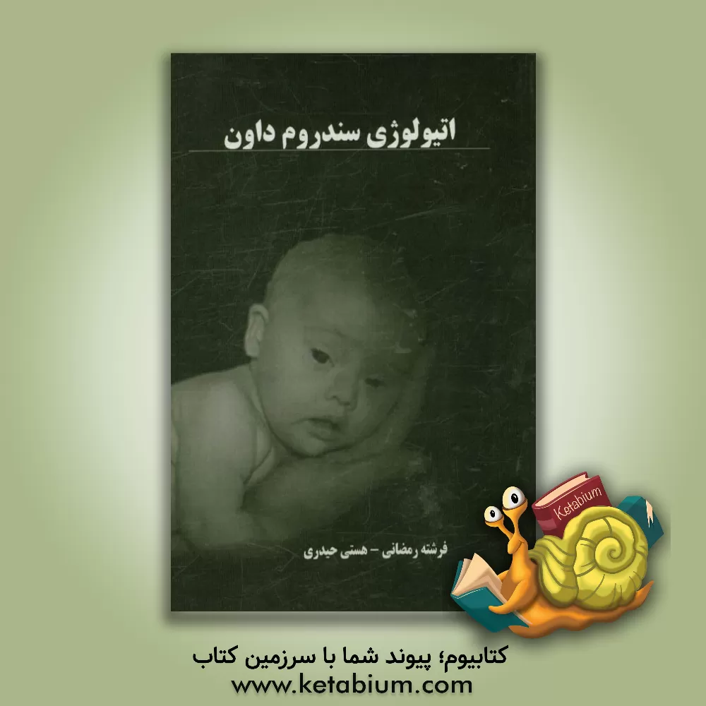 کتاب اتیولوژی سندروم داون اثر فرشته رمضانی