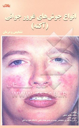 کتاب انواع جوشهای غرور جوانی (آکنه) تشخیص و درمان اثر محمدهاشم حنفی