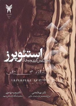 کتاب اوستئوپروز (پوکی استخوان): راه های پیش گیری و درمان آن |اثر مرضیه مهاجری