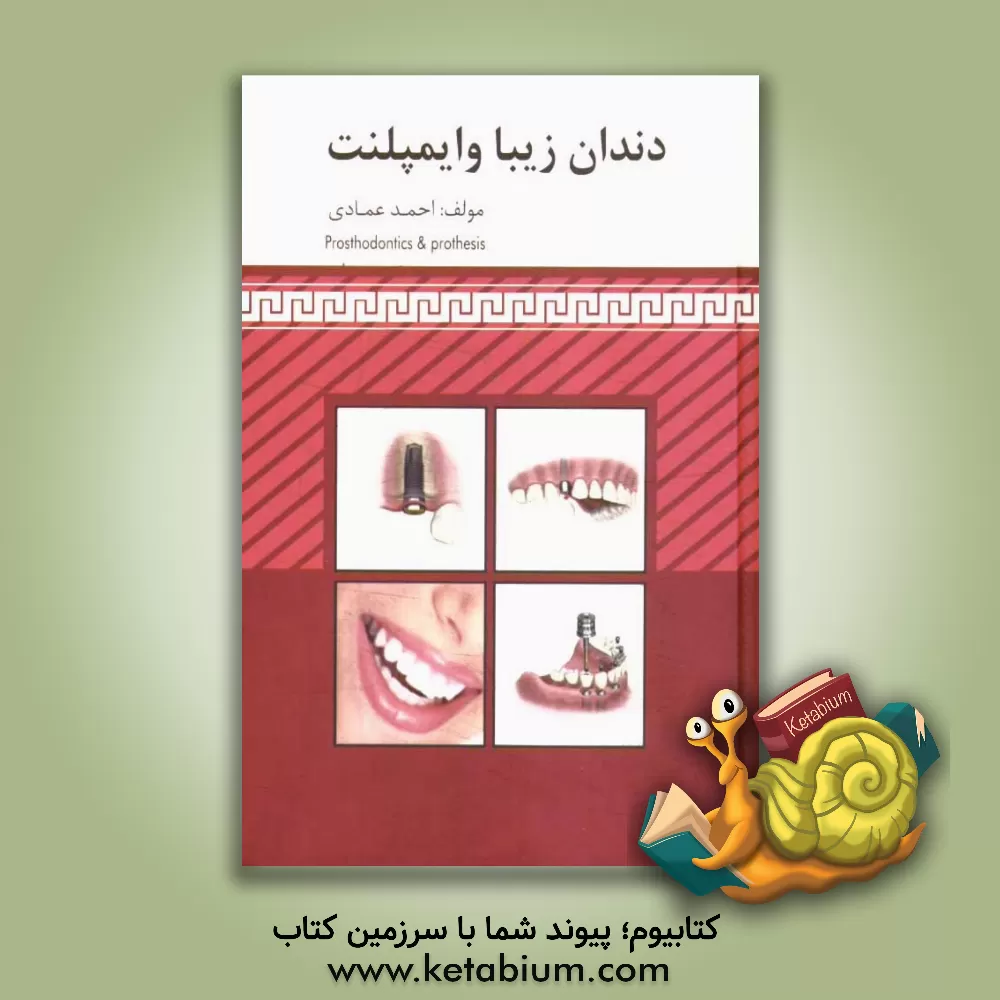 کتاب دندان زیبا و ایمپلنت اثر احمد عمادی