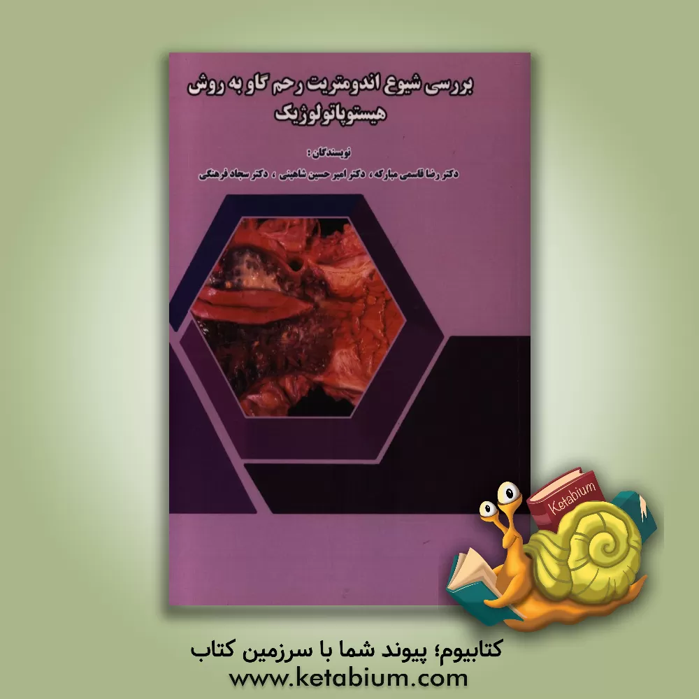 کتاب بررسی شیوع اندومتریت رحم گاو به روش هیستوپاتولوژیک اثر امیرحسین شاهینی