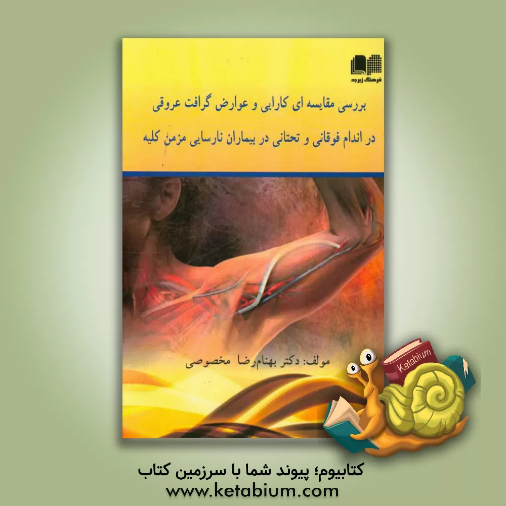 کتاب بررسی مقایسه ای کارایی و عوارض گرافت عروقی در اندام فوقانی و تحتانی در بیماران نارسایی مزمن کلیه اثر بهنام‌رضا مخصوصی